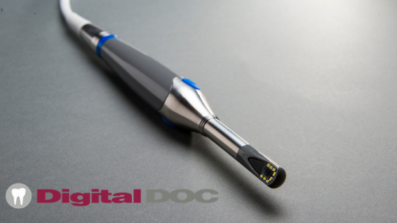 Digital Doc - Autofocusing Intraoral Camera