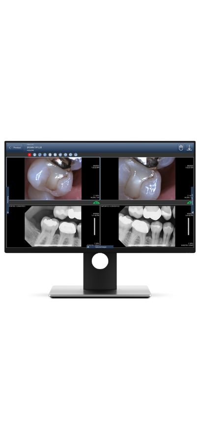 dental imaging software