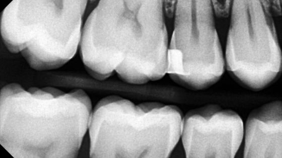 Why Dental Camera Clarity Matters